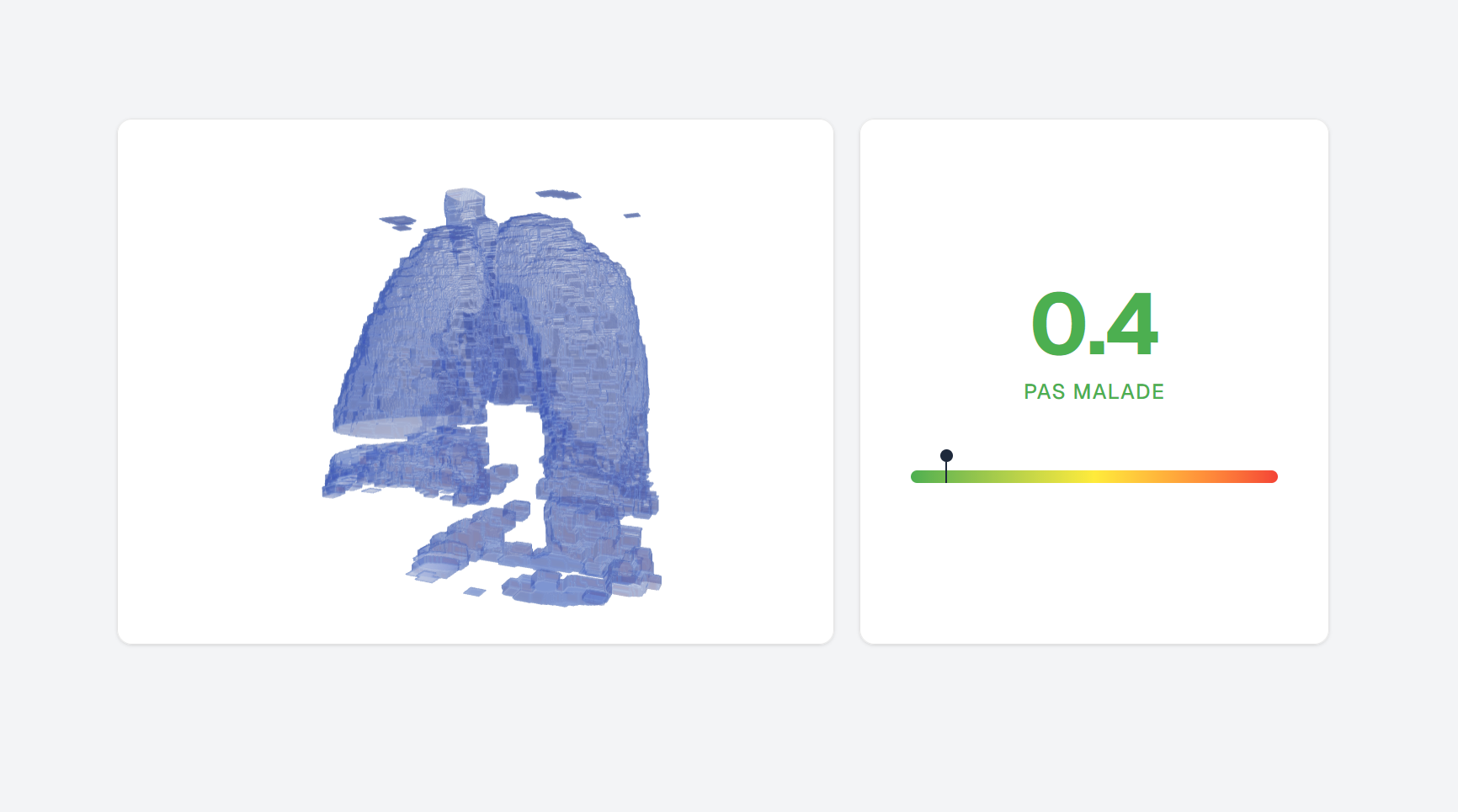 Medical imaging application for pulmonary fibrosis