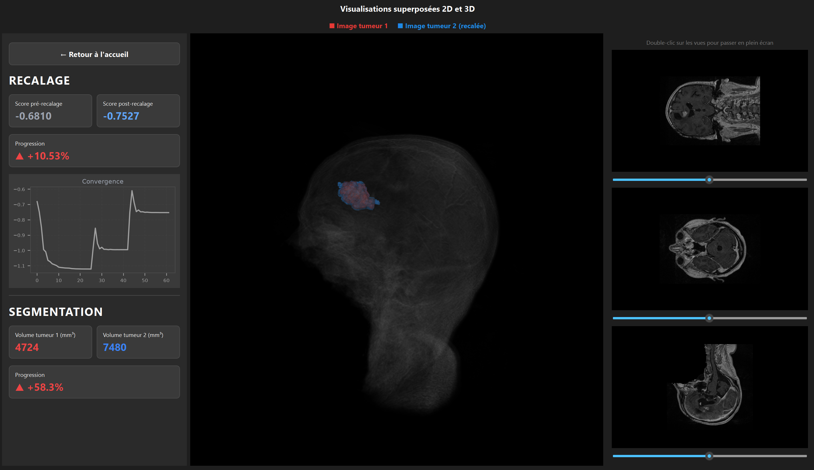 Interface utilisateur PyQt6 / VTK de l'application